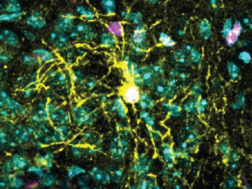 תא מסוג אוליגודנדרוציט על שלל שלוחותיו (בצהוב) במקטע מוח של עכבר. מגיב ללחץ באופן שונה לגמרי בזכרים ובנקבות