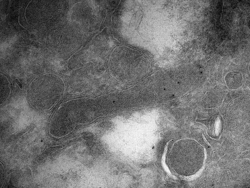 תא חיידק (מאורך, במרכז התמונה) בתוך תא של סרטן מוח מסוג גליובלסטומה, כפי שנראה מבעד למיקרוסקופ אלקטרונים. הנקודות השחורות בתא החיידק – נוגדנים מהונדסים שנושאים חלקיקי זהב ונקשרים באופן ממוקד לרכיב הקיים רק במעטפת התא של חיידקים ולא בתאים אנושיים