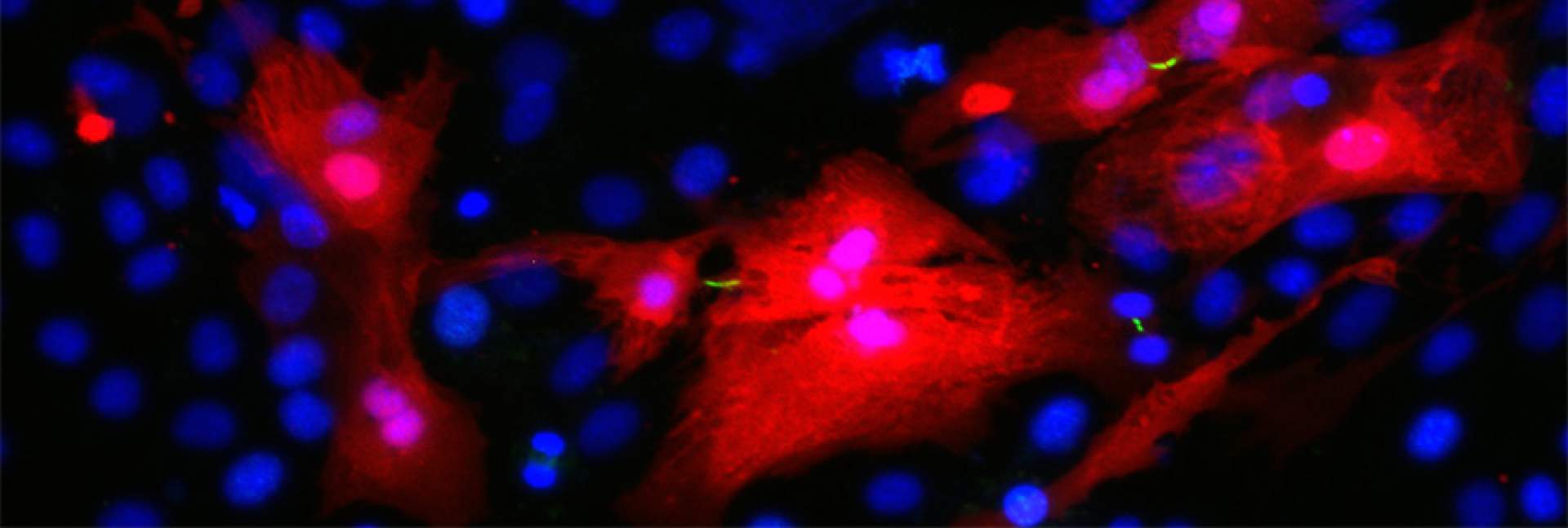 התחדשות רקמת לב תחת המיקרוסקופ. בתמונה ניתן להבחין בפסים דקים ירוקים המסמנים את חריצי ההתלמה (cleavage furrows) הנוצרים בין תאי שריר הלב (באדום) המתחלקים