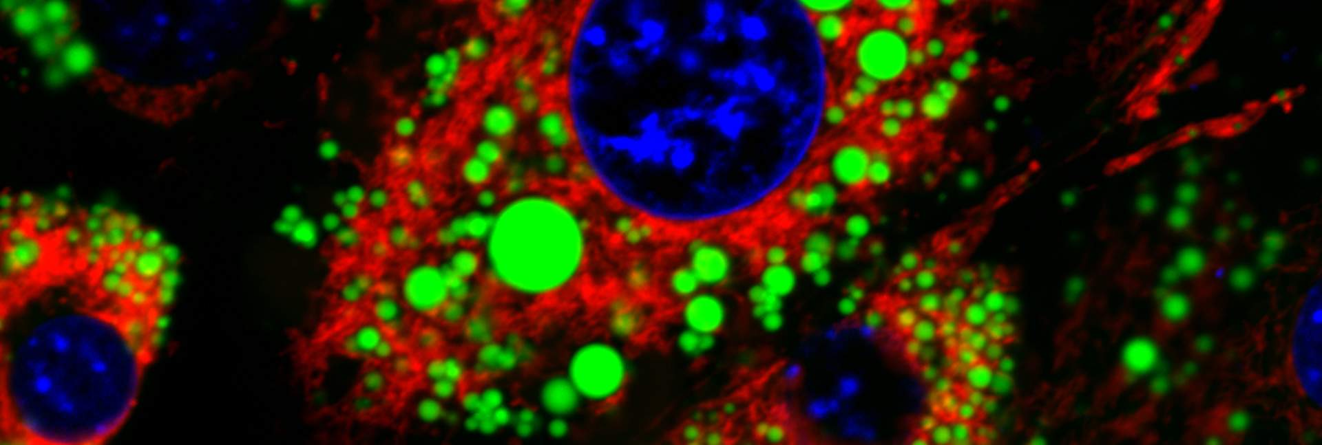 Fat cells
