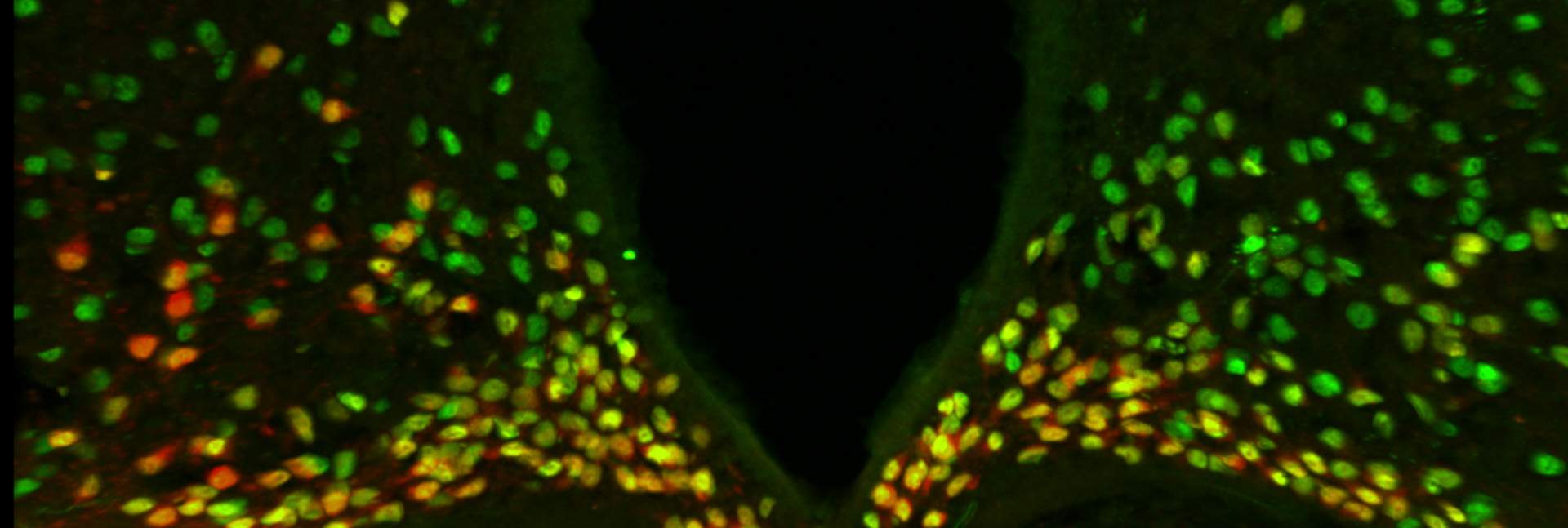 A portion of the mouse hypothalamus reveals that the protein made by the Otp gene (green) is expressed in all the neurons (red) that drive hunger – and the combined color is therefore yellow. It was known that in the developing brain, Otp is needed for the generation of these neurons. The study found that during adulthood, Otp is crucial for causing these neurons to express AgRP, a major hunger-promoting substance
