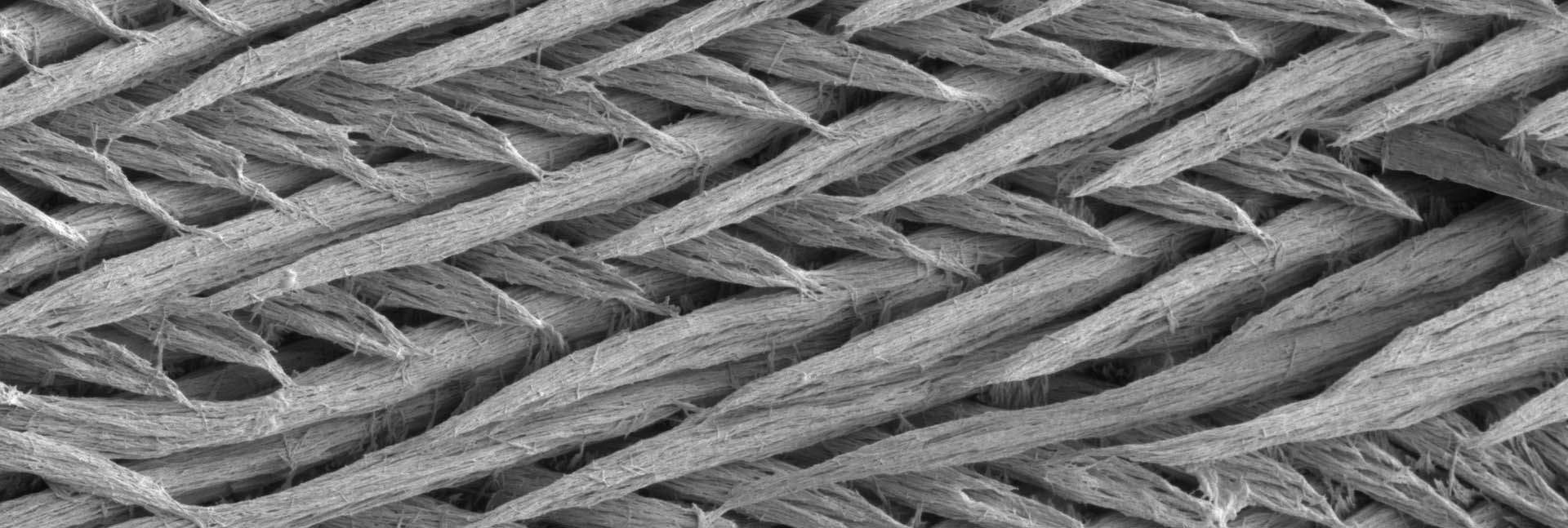 תמונות מיקרוסקופ אלקטרונים של שכבת האמייל העוטפת שיני עכבר