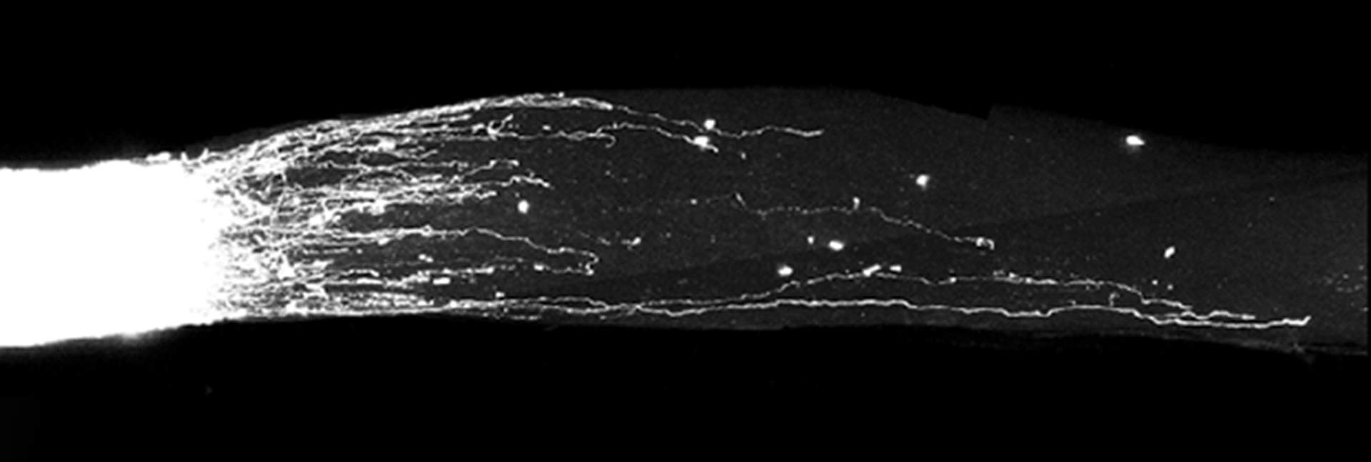 Overexpression of genes from the B2-SINE family in retinal ganglion neurons led to accelerated growth after injury