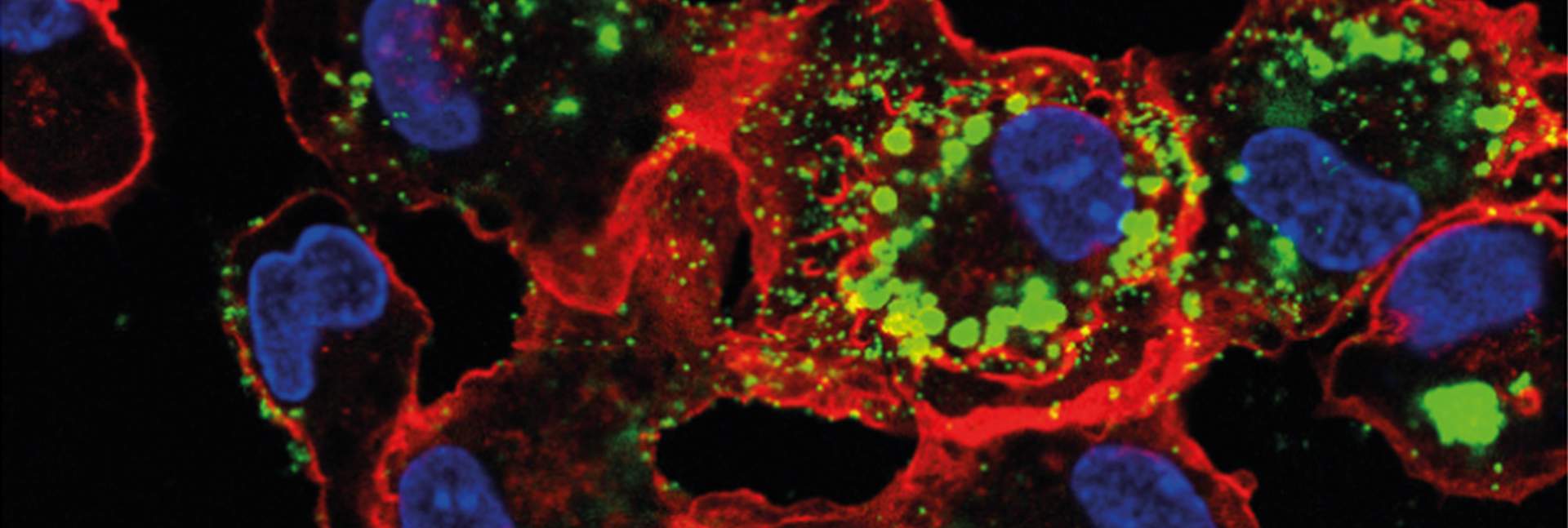 Infected macrophages