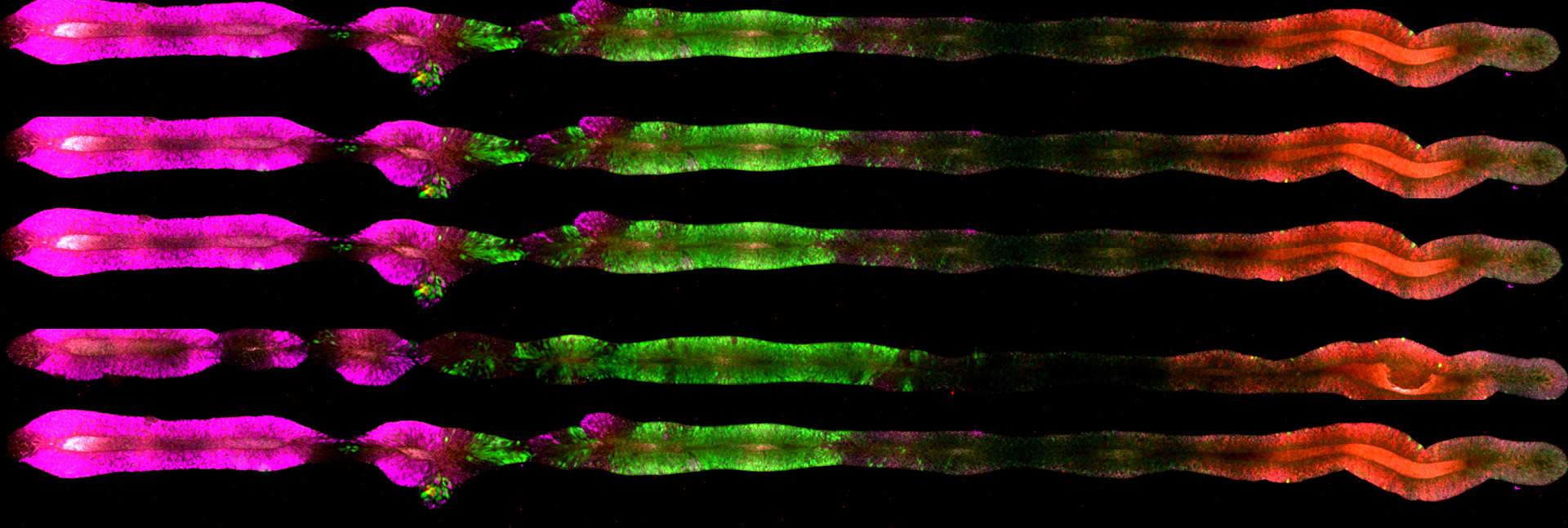 Researchers used color-coded proteins to reveal the identity of the cells in the organoids they produced. In four organoids that simulate the embryo’s central nervous system, the magenta marks proteins associated with the development of the forebrain and the midbrain, the green, the hindbrain and the red, the center of the spinal cord