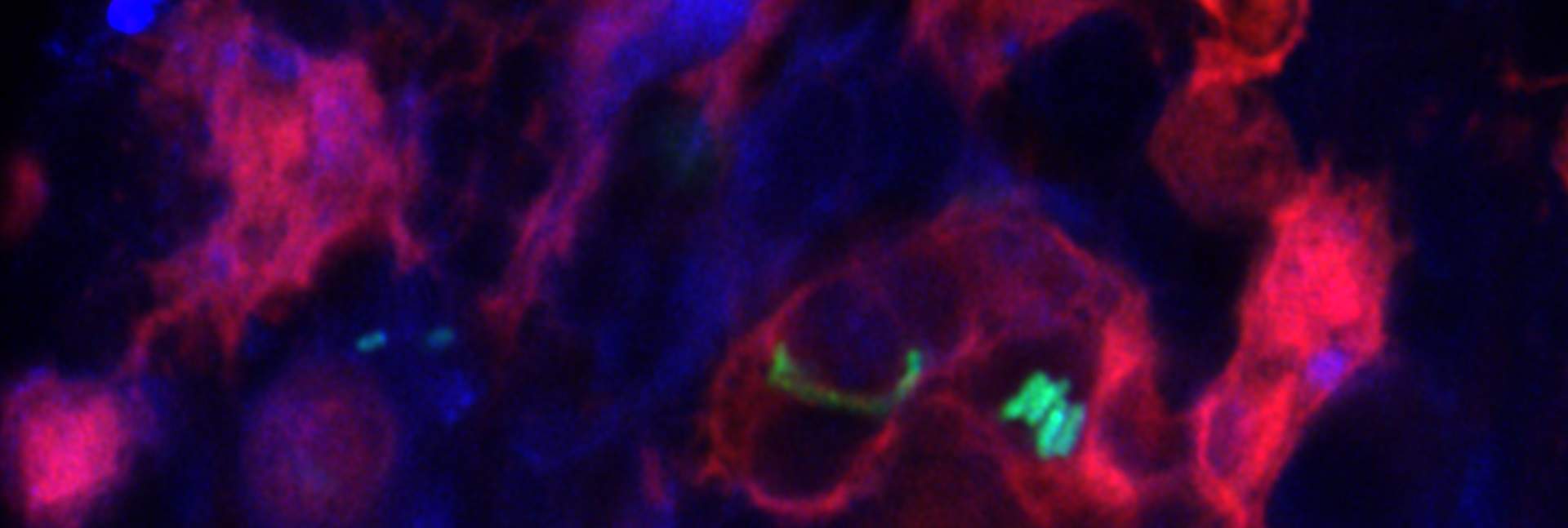 Fluorescence microscopy image of Salmonella (green) engulfed by splenic macrophages (red; blue – cell nuclei)