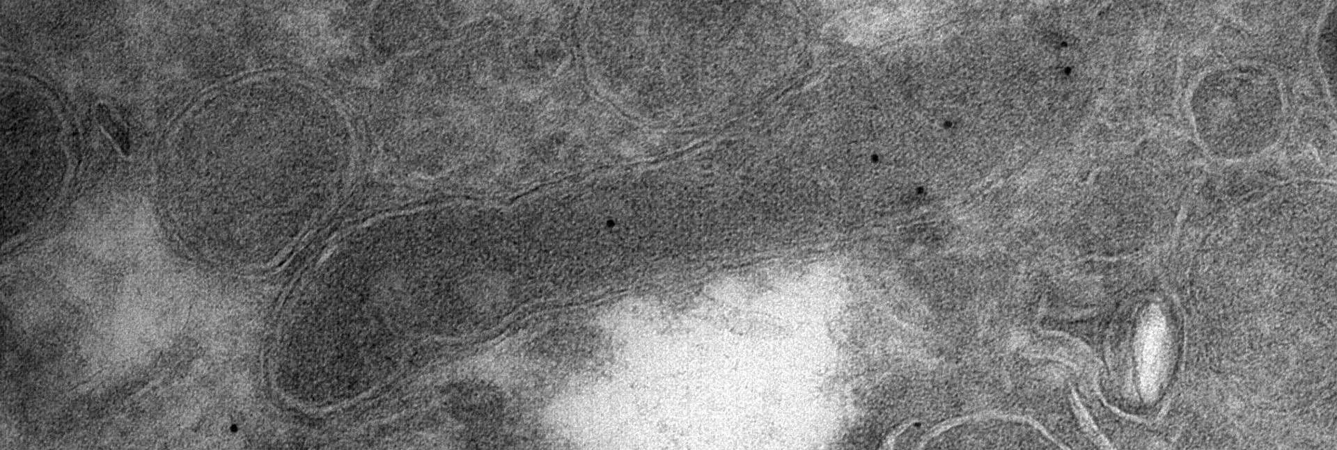 A bacterial cell (elongated shape in the center) inside a glioblastoma tumor cell, as seen through an electron microscope. The black dots within the bacterium are engineered antibodies carrying gold particles that bind specifically to a component found only in bacterial cell envelopes and not in human cells