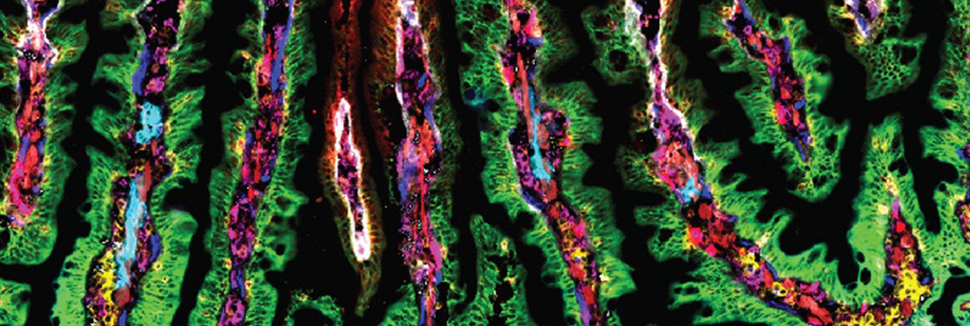 An image of tissue from the human small intestine obtained with the help of fluorescent dyes that made it possible to mark numerous proteins in parallel, thereby mapping out the various proteins produced in each part of the intestinal villi