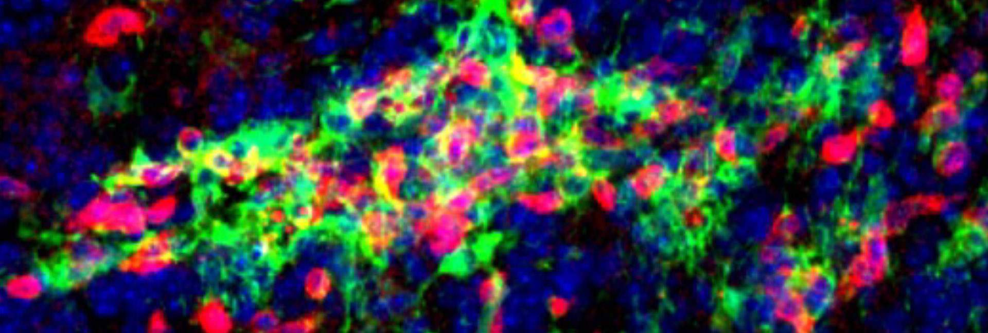 מקבצים של תאי מיקרוגליה (בירוק) ותאי T (באדום) במוח עכבר עם מחלה דמוית טרשת נפוצה