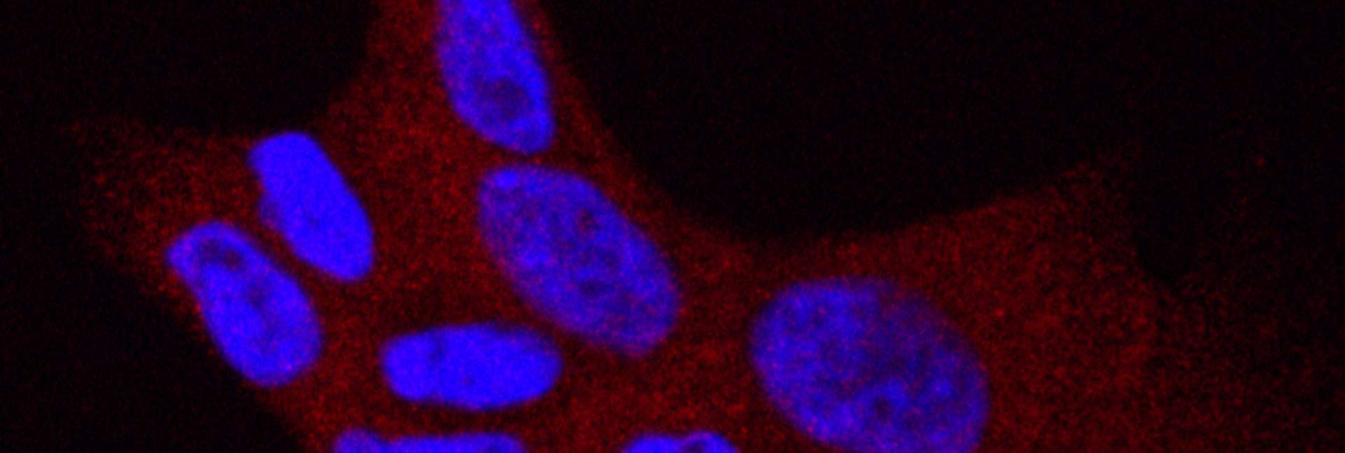 תאי סרטן ריאות אנושיים עם המוטציה L858R בגן EGFR. בכחול – גרעיני התאים. באדום – חלבון המופיע בנוזל התא כאשר קולטני EGFR פעילים ודוחפים את התא לחלוקה בלתי-מבוקרת