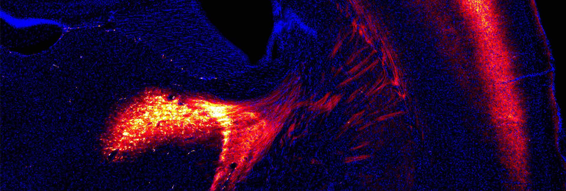 מקטע מוח של עכבר. החלקים המוארים באדום – מסלולי תקשורת בין תאי עצב אשר מבטאים את חלבון היתוש. בכחול – גרעיני התאים