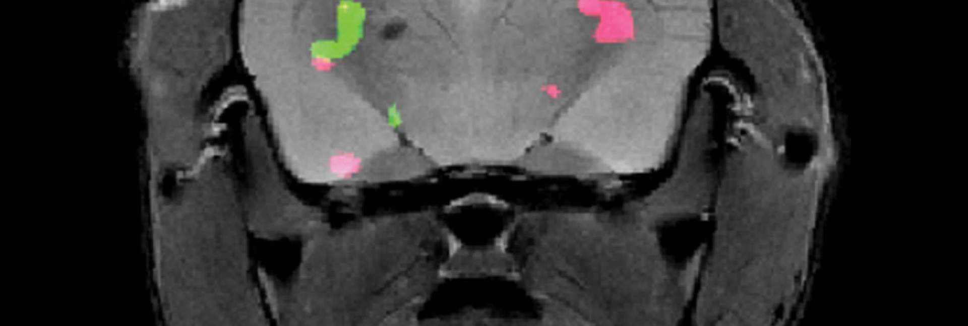 Two different proteins expressed in a mouse brain are revealed by dual-color MRI