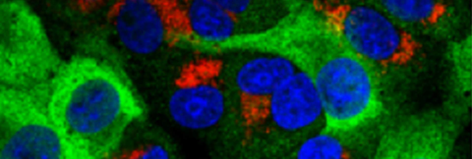 SARS-CoV-2 infected cells