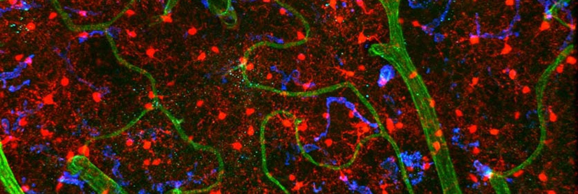 רקמת מוח של עכבר. תאי המיקרוגליה דמויי התמנון מסומנים באדום. בירוק – כלי הדם