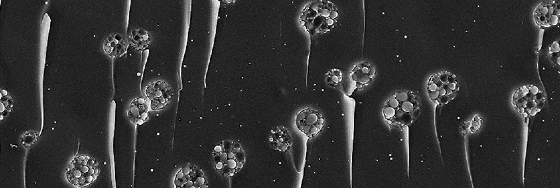 lipids in hydrogel 