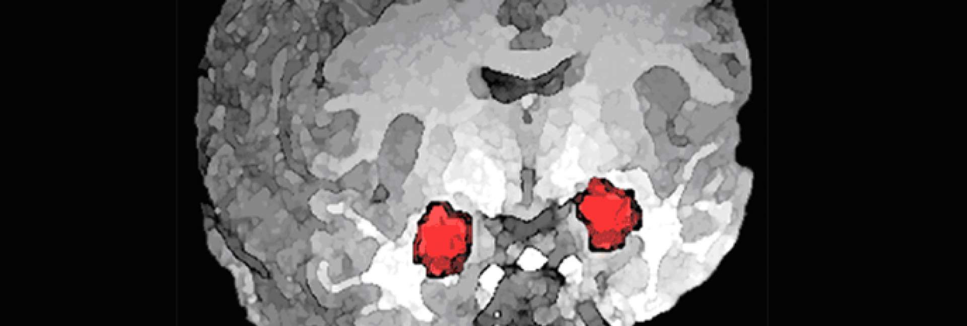 האמיגדלה (באדום) – מבנה מוחי דמוי שקד הנמצא בעומק האונה הרקתית של יונקים רבים, ובהם האדם. מעורבת בתהליכי למידה אסוציאטיבית שבהם נוצרת זיקה בין קלט חושי מסוים לחוויות חיוביות או שליליות