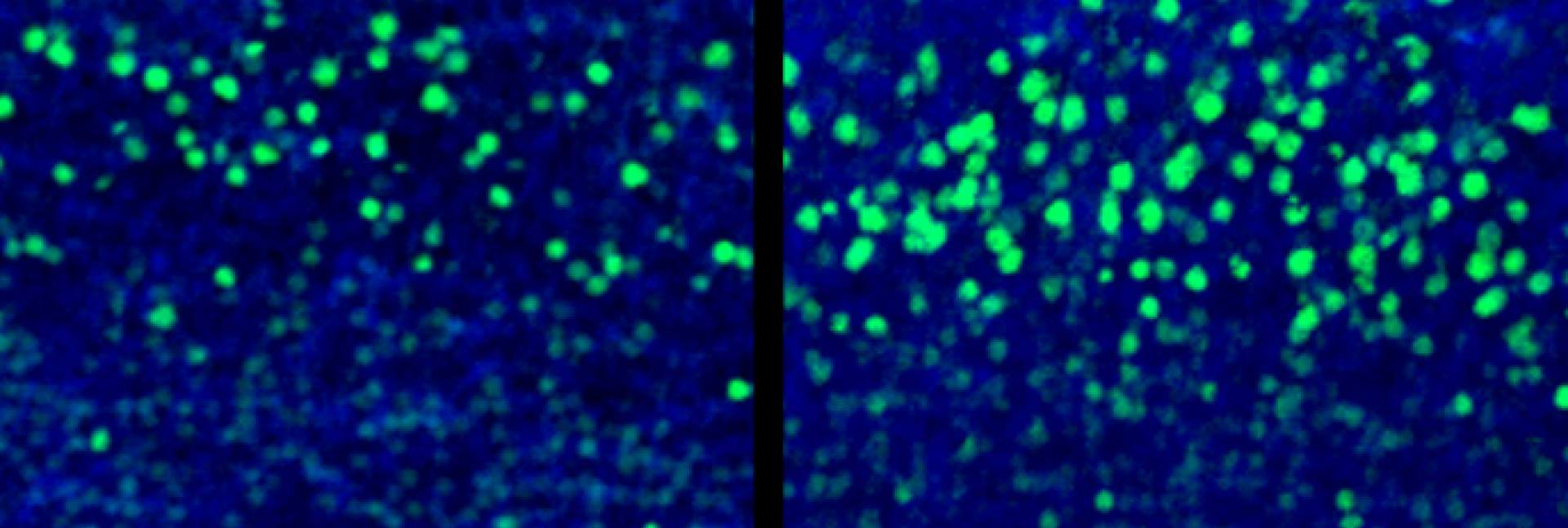 neurons in mouse brains