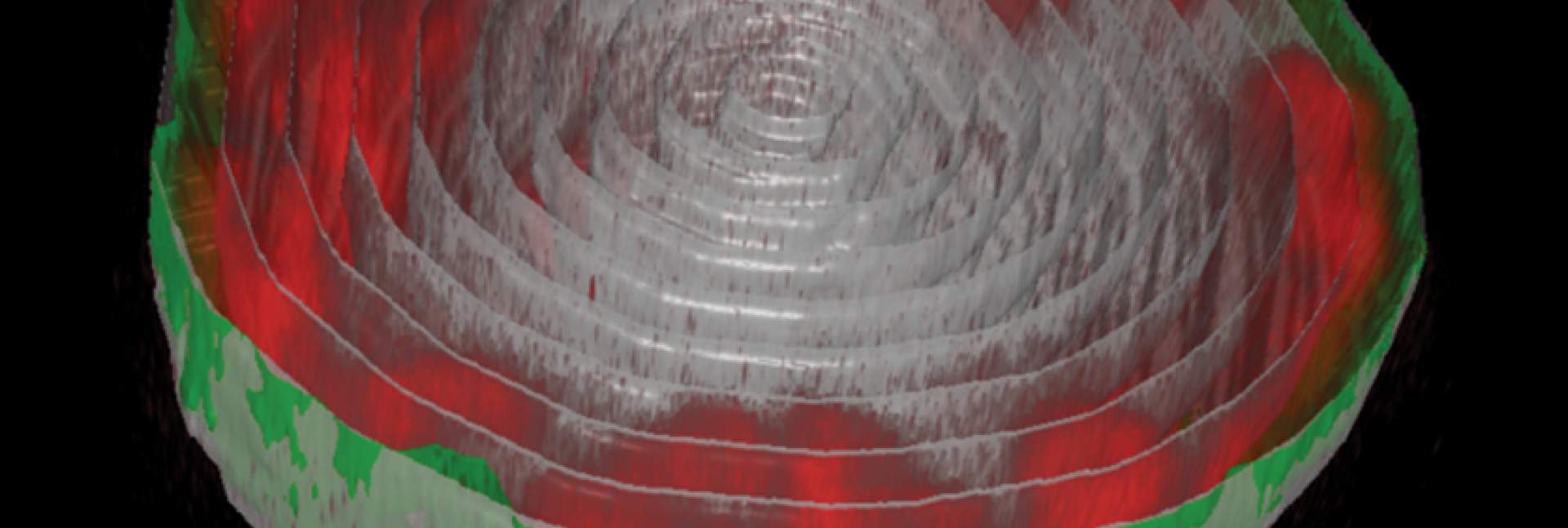 The nucleus of a fruit fly larva’s muscle cell. The long chains of DNA (red) are attached to the nuclear lamina (green) – the inner layer of the nuclear membrane 