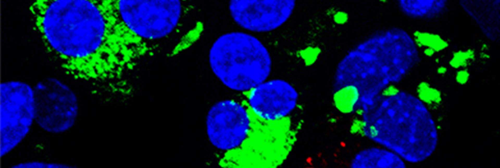 Reprogrammed cells: β cells expressing insulin (green) and the closely related δ cells expressing somatostatin (red). Blue staining shows cell nuclei. Many reprogrammed cells contain two nuclei (a unique feature of some exocrine cells) demonstrating their exocrine cell origin