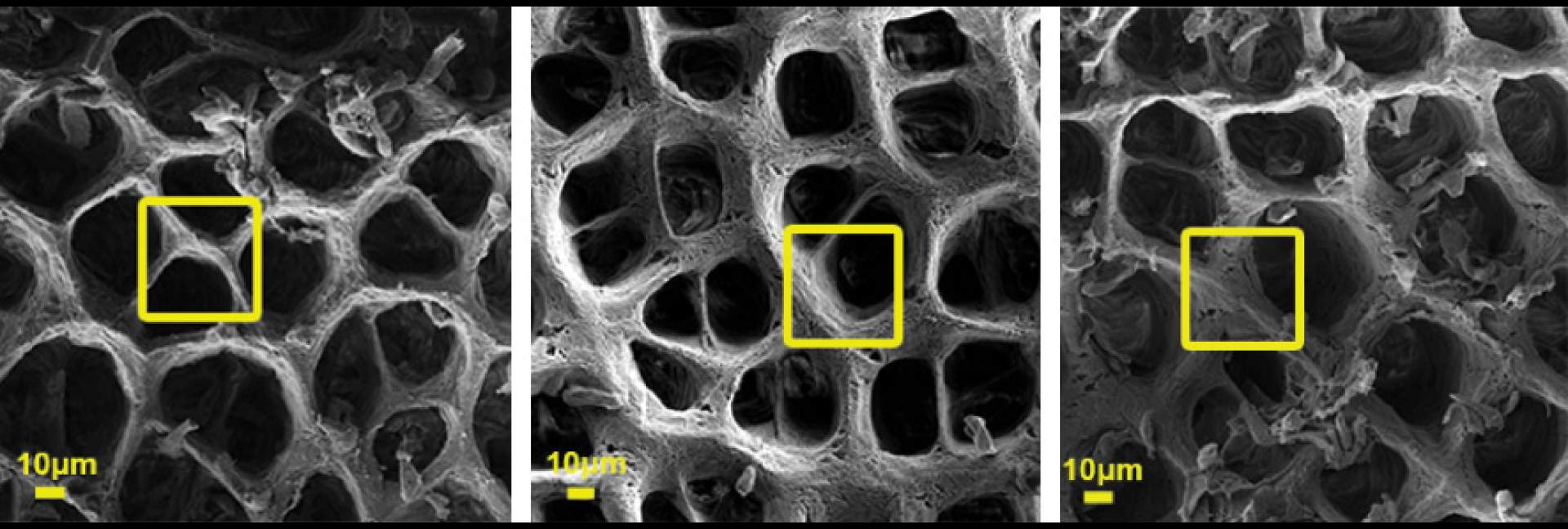 המרקם הבין-תאי במעי תחת מיקרוסקופ אלקטרונים סורק
