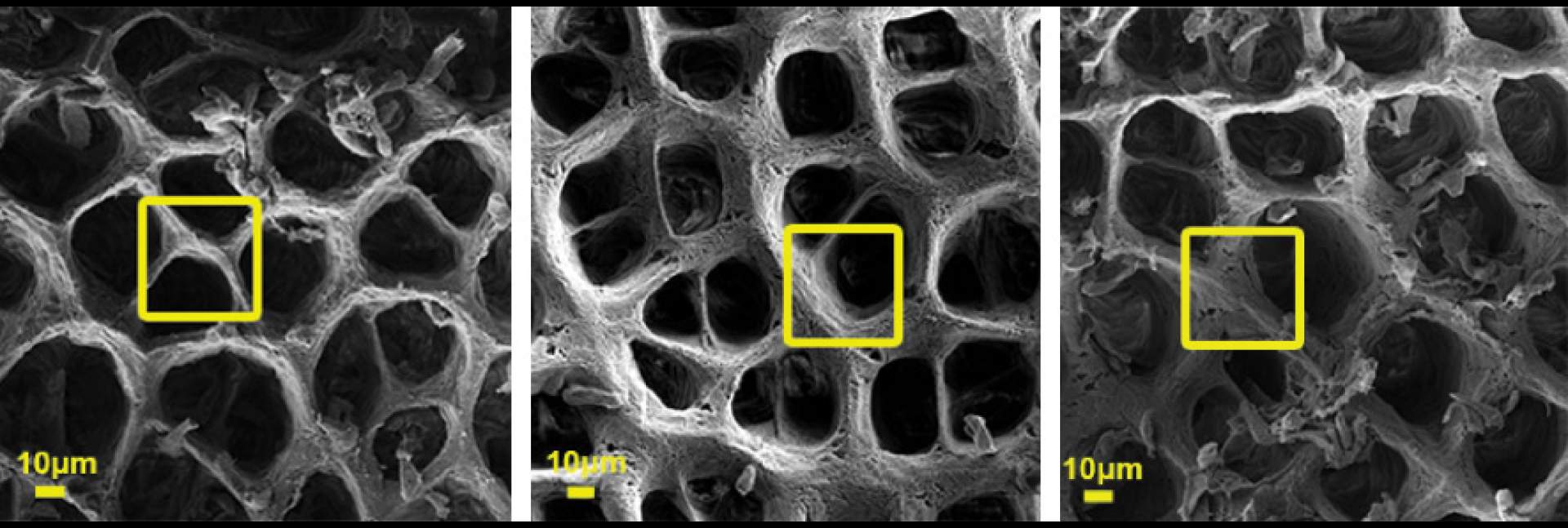 The extracellular matrix as captured by a scanning electron microscope (SEM)