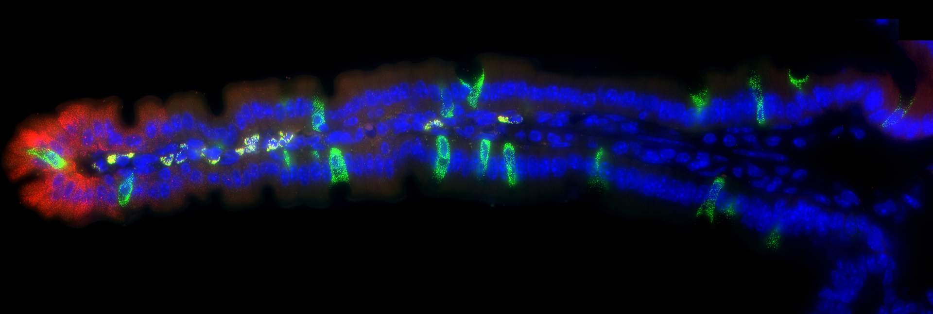 ילום מיקרוסקופי פלואורסצנטי של התבטאות גנים (באדום ובירוק) באזורים מסוימים לאורך סיס המעי (בכחול - גרעיני התאים)