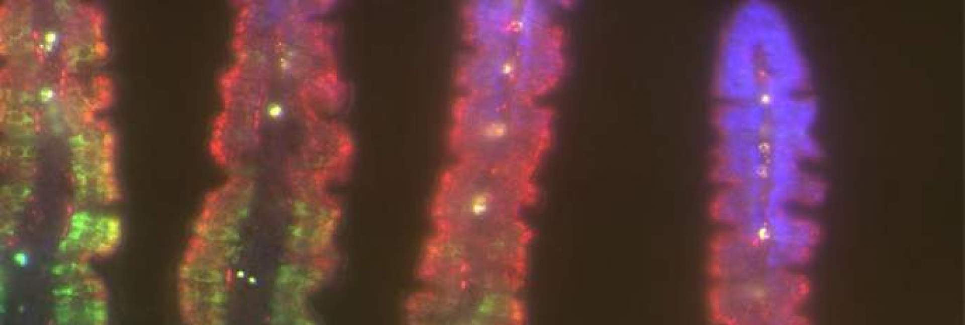 villi