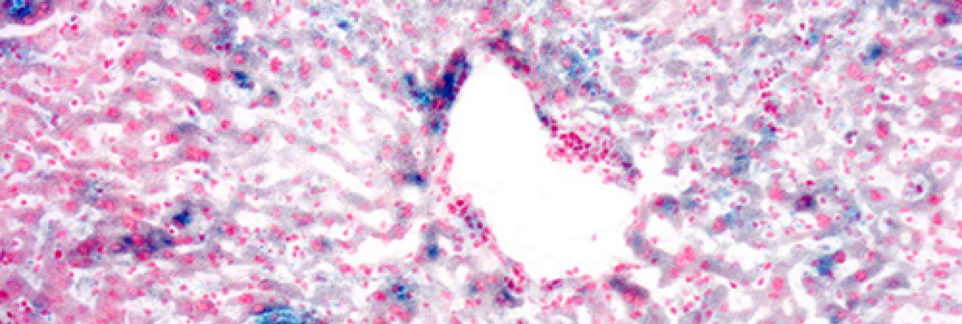 Senescent cells