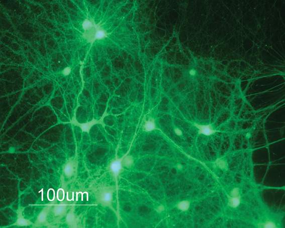 תרבית של תאי עצב מודבקים בנגיף הנושא מולקולות קצרות של אר-אן-אי, אשר גורמות להפחתת הביטוי של הגן ל-CRF באופן ממוקד, במיקום מסוים במוח העכבר