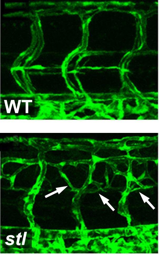 In the bottom microscope image, a mutation causes increased blood vessel growth, in contrast with those in a normal zebrafish embryo (top)