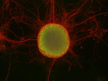 מושבה של תאי גזע (במרכז, בירוק), מוקפת בתאי עצב (באדום)