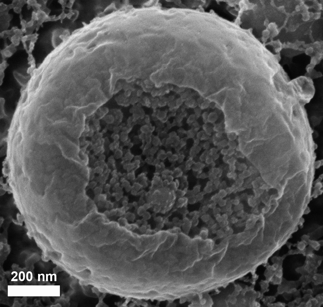 צילום במיקרוסקופ אלקטרונים סורק: שלפוחית המכילה ננו-כדוריות של סידן פחמתי, שגודלן 20 עד 30 ננו-מטרים, בדגימת עובר קיפוד ים קפואה