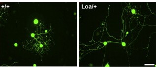 בתאי עצב מוטנטיים (מימין), בהם מופחתת כמות הדיינין, צומחות השלוחות לאורך גדול יותר מזה של תאי העצב הרגילים (משמאל)