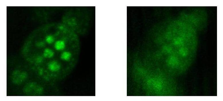 תמונה מיקרוסקופית של תאים שנעשתה באמצעות שיטת המיקוד הטמפורלית (משמאל) או ללא מיקוד טמפורלי (מימין)