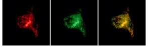 תאים המבטאים את החלבון SARAF(צבוע בסמן פלואורסצנטי אדום), ותאים המבטאים STIM1 (צבוע בסמן פלואורסצנטי ירוק). התמונה הימנית, בה נראים שני החלבונים, מראה כי הם מצויים ביחד